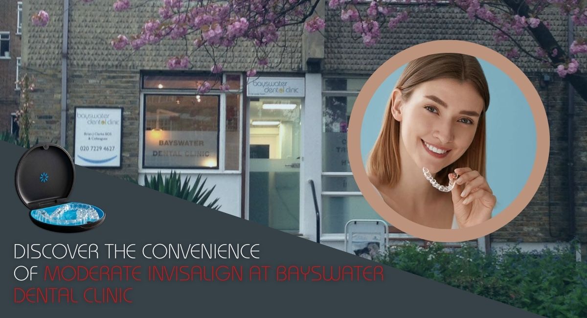 Discover the Convenience of Moderate Invisalign at Bays water Dental Clinic