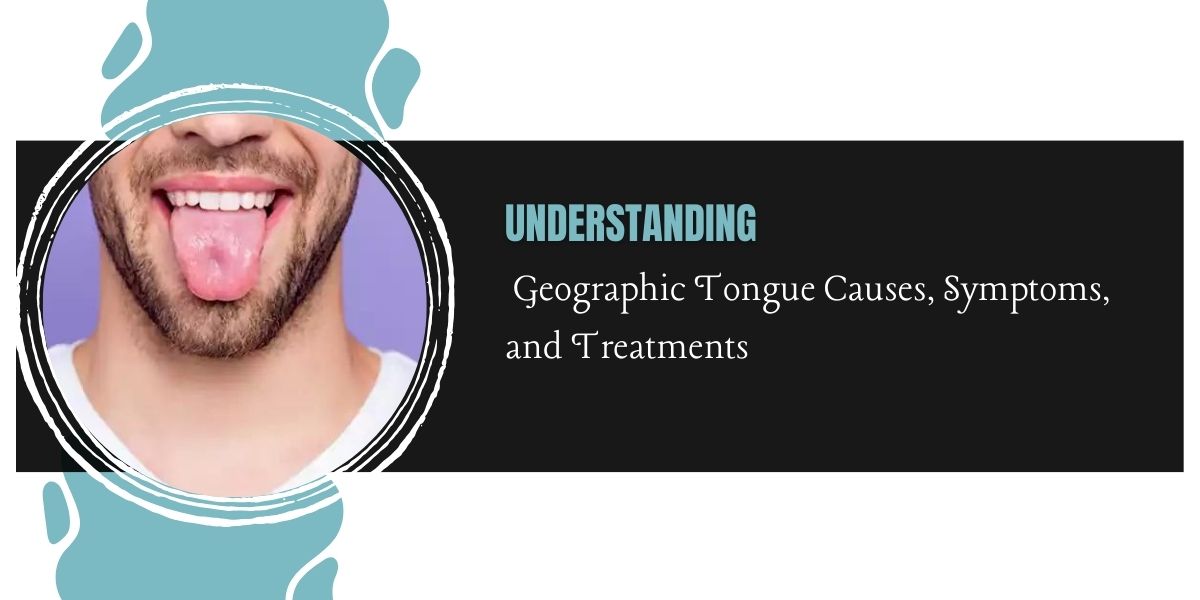 Understanding Geographic Tongue Causes, Symptoms, and Treatments