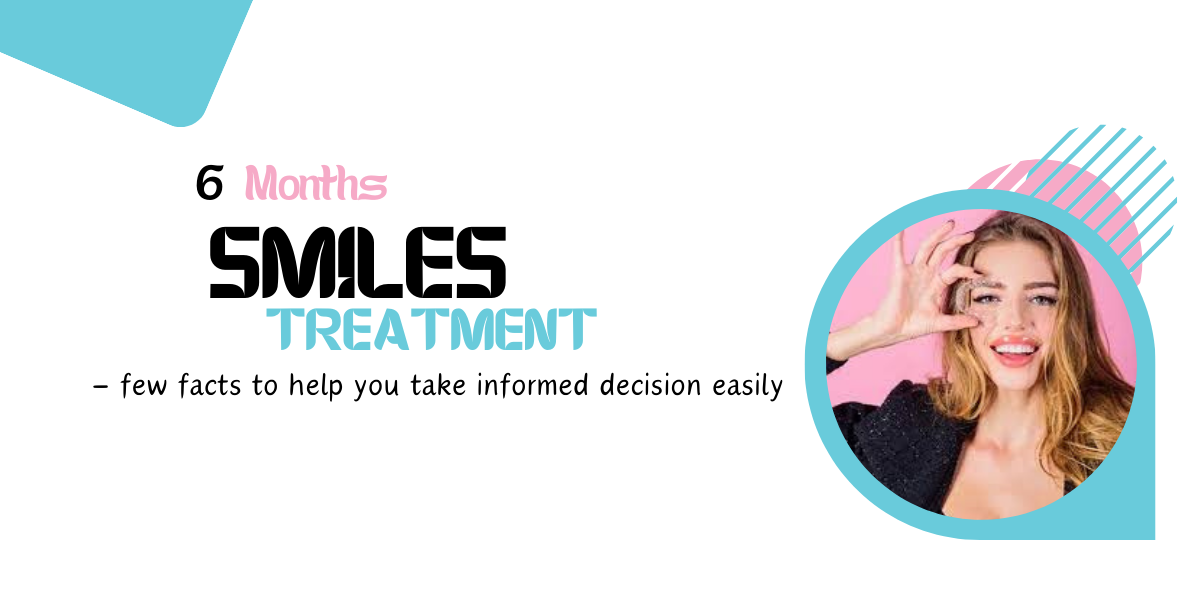 Six Months Smiles treatment help you take informed decision easily